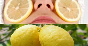 Il motivo per cui il limone è un buon rimedio naturale per eliminare i brufoli
