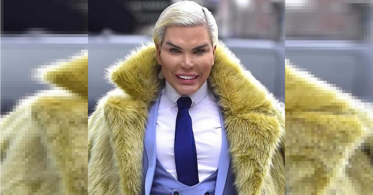 Rodrigo Alves: Il suo primo intervento è avvenuto nel 2004, tra ieri e oggi il cambiamento è netto. Ecco le foto prima e dopo del vecchio Ken Umano Rodrigo Alves: Il suo primo intervento è avvenuto nel 2004, tra ieri e oggi il cambiamento è netto. Ecco le foto prima e dopo del vecchio Ken Umano