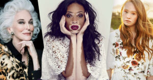 9 modelle con una bellezza così particolare da essere uniche