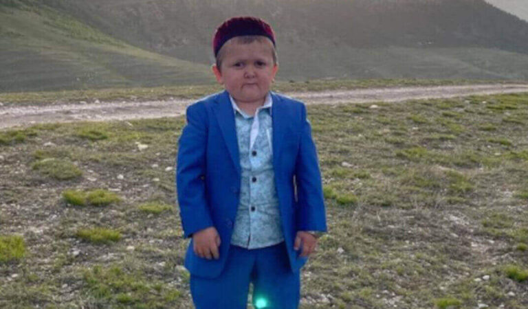 Hasbullah Magomedov, il 18enne russo che dimostra 5 anni a causa di un’alterazione genetica Hasbullah Magomedov, il 18enne russo che dimostra 5 anni a causa di un’alterazione genetica