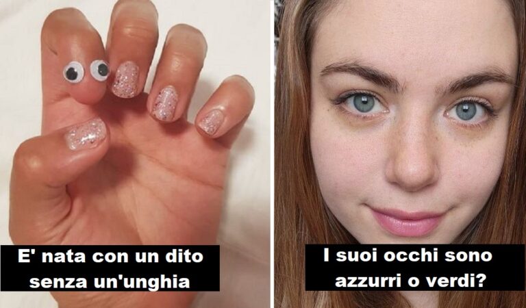 15 tratti fisici distintivi che rendono alcune persone uniche 15 tratti fisici distintivi che rendono alcune persone uniche