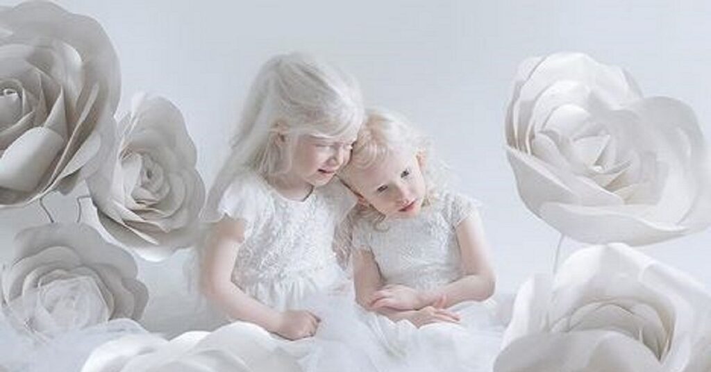 Porcelain Beauty: 16 foto di persone con albinismo ritratte nella loro bellezza unica
