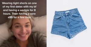 Un giovane negli USA ha quasi perso un gluteo dopo aver contratto un’infezione per aver indossato pantaloncini di jeans