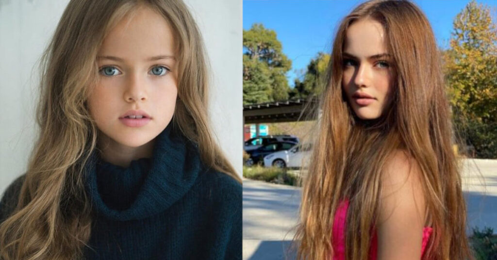 10 bambine che una volta erano famose come piccole modelle e oggi sono ancora più belle