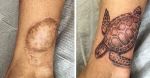 16 tatuaggi che hanno nascosto delle cicatrici e aumentato l’autostima a chi li ha voluti sulla propria pelle