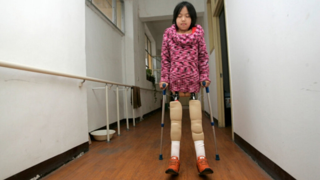 Una straordinaria storia di resilienza e rinascita dopo un incidente che le ha tolto le gambe