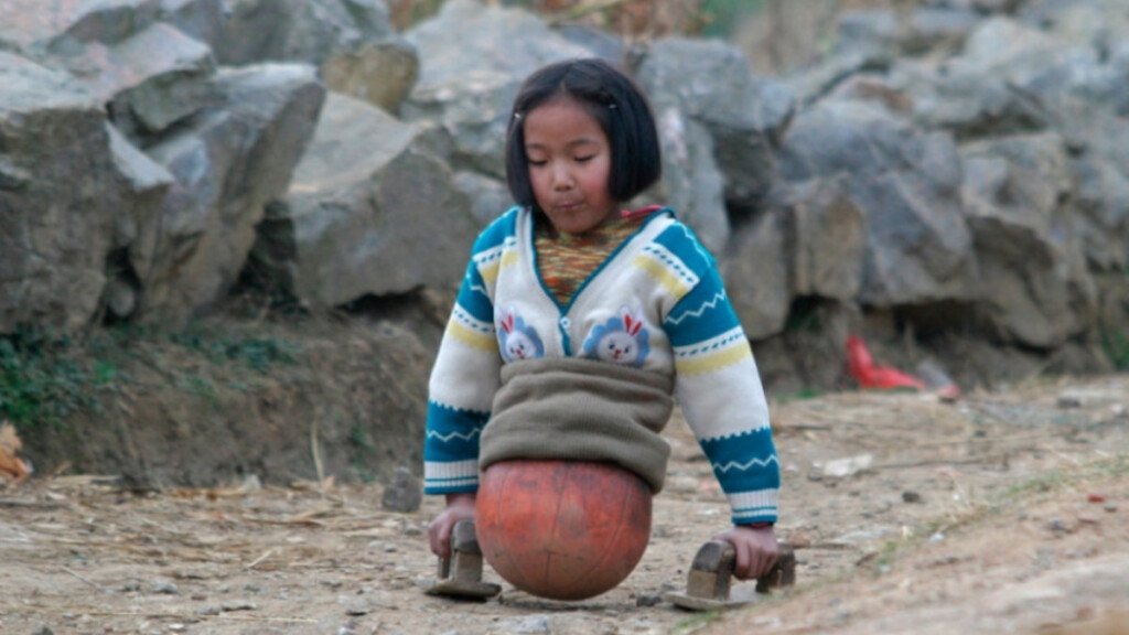 Dalla palla da basket alle protesi: la coraggiosa battaglia di Qiana per la felicità