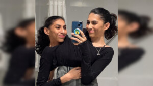 Carmen e Lupita le gemelle siamesi più famose del Web parlano della loro intimità: “Siamo due persone distinte”